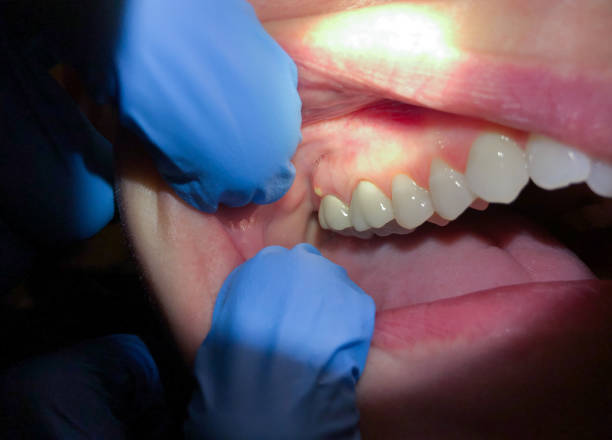 Best Emergency Dental Care for Sports Injuries in Wilson, AR